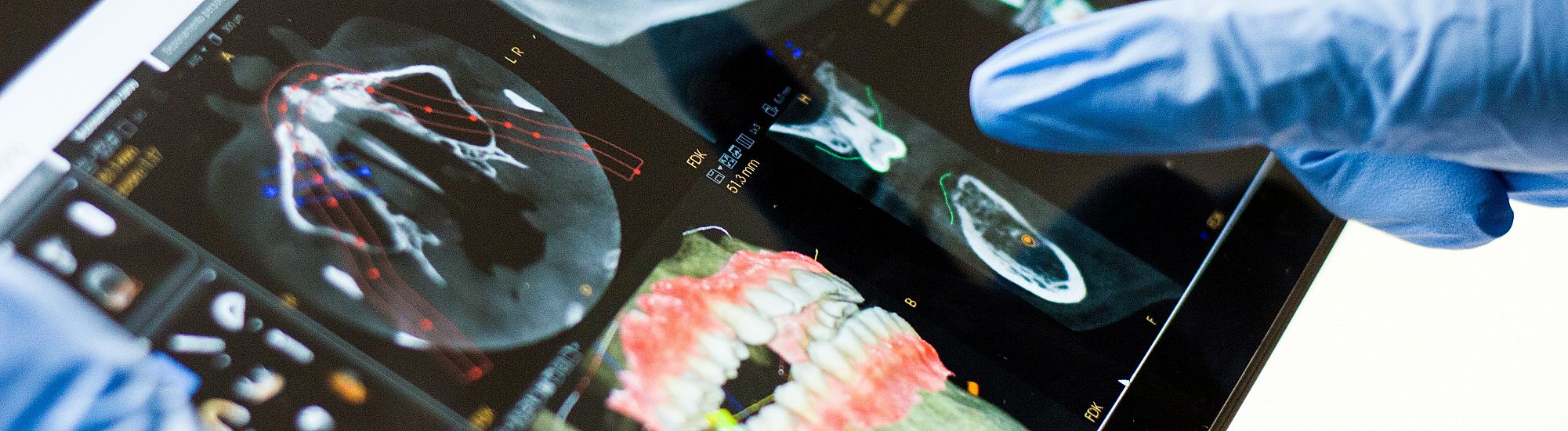Embracing the Future: Advancements in Digital Dentistry and Their Impact on Patient Care